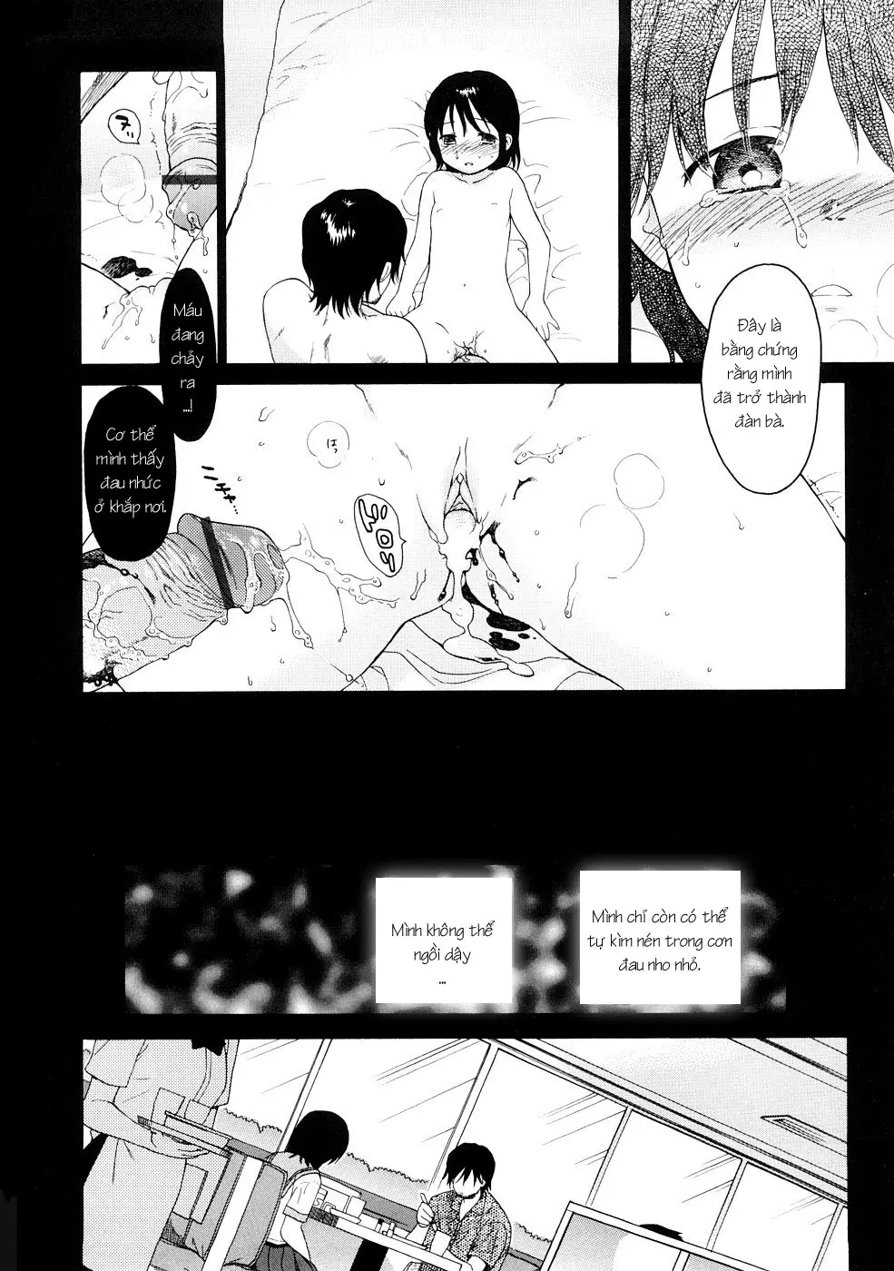 YOUR DOG Ch. 1-8 - Full trang 174
